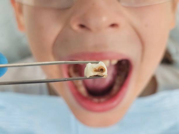 Best Same-Day Emergency Dental Services in Burney, CA
